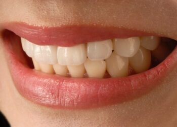 Mujer enseñando los dientes