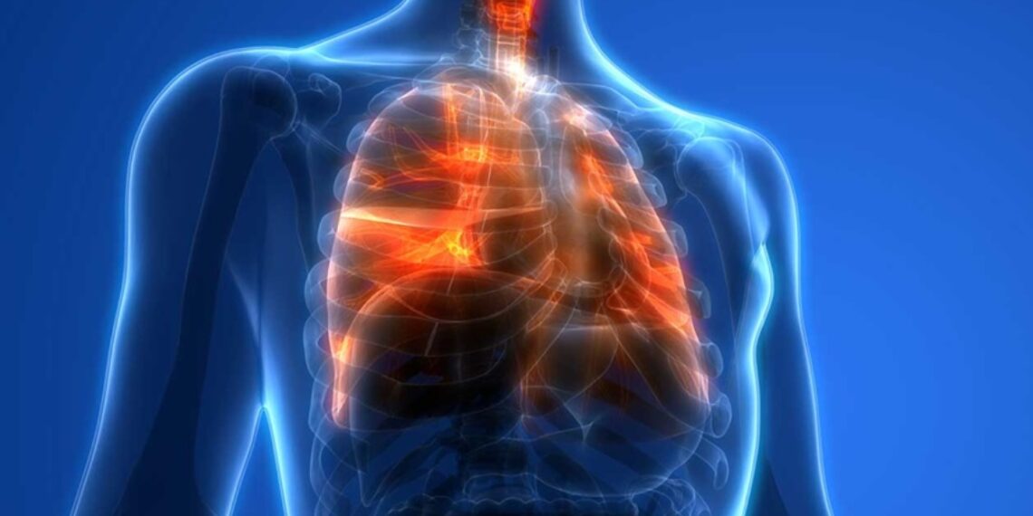 terapia con células madre