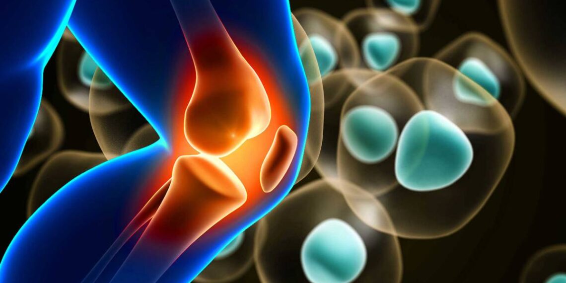 ¿Cómo se transforma la medicina con células madre regenerativas?